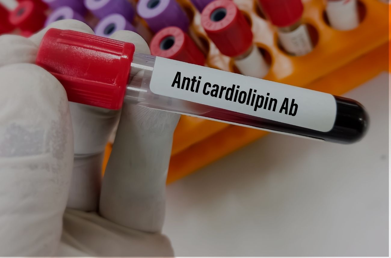 Antiphospholipid Syndrome Symptoms Causes Treatment Cult fit Antiphospholipid syndrome symptoms causes treatment cult fit